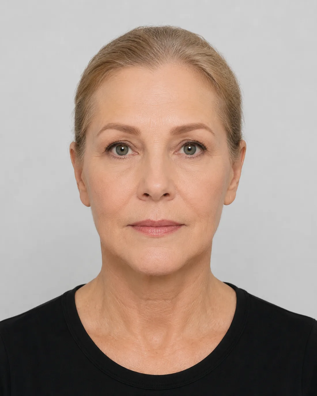 Portret van dezelfde vrouw na een facelift